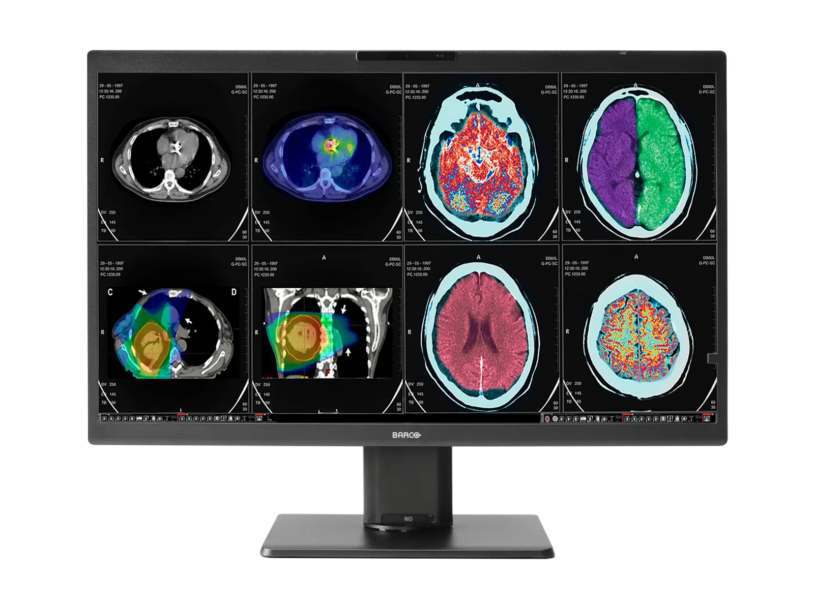 Best-Selling General Radiology Displays