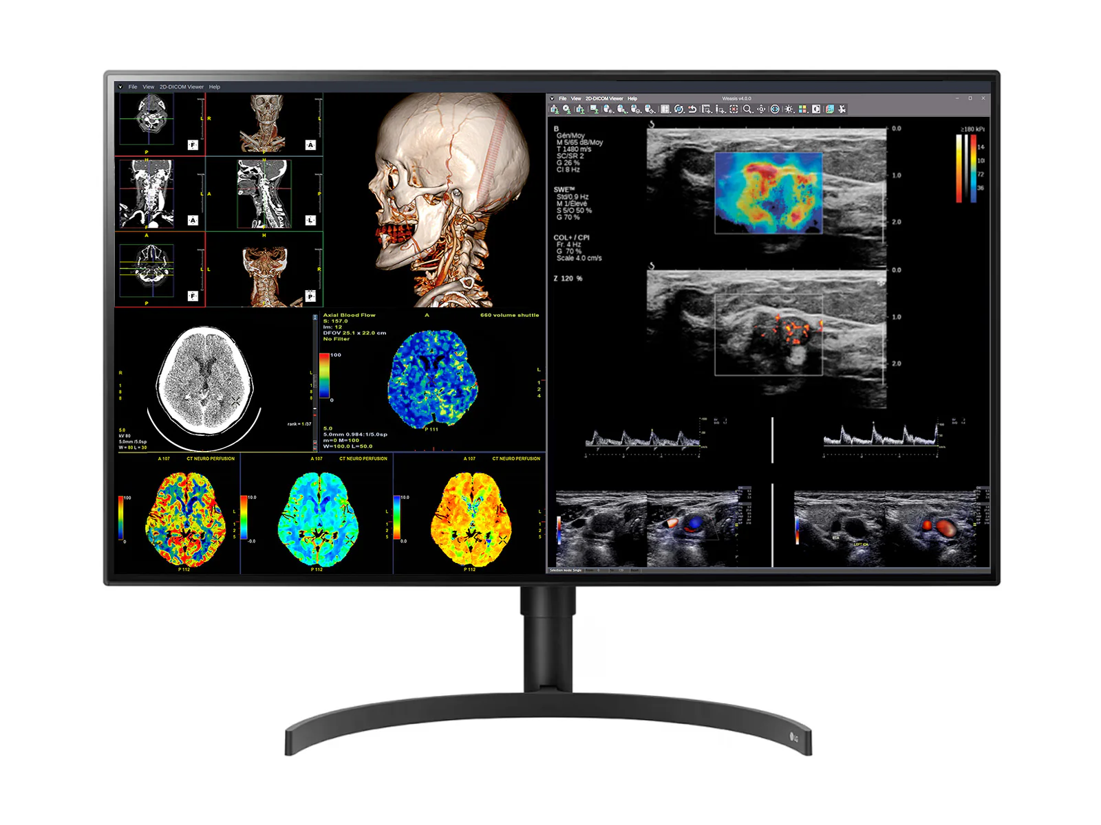 Best Selling Medical Monitors